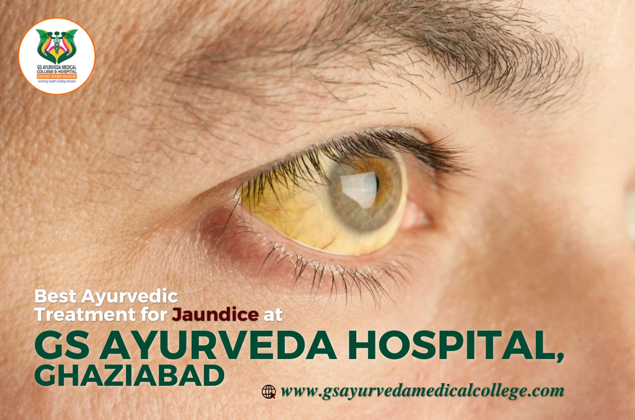 Best Ayurvedic Treatment for Jaundice at GS Ayurveda Hospital, Ghaziabad