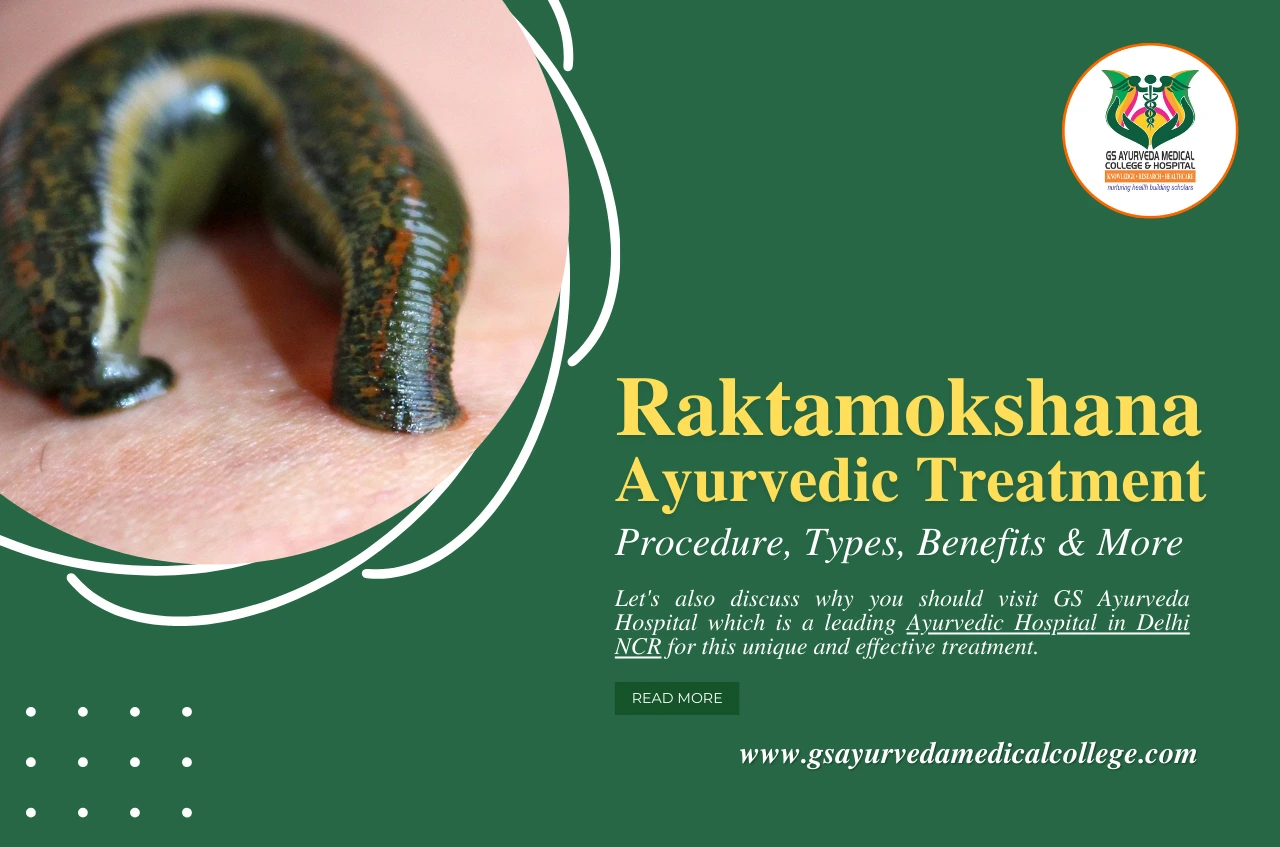 Raktamokshana Ayurvedic Treatment: Procedure, Types, Benefits & More