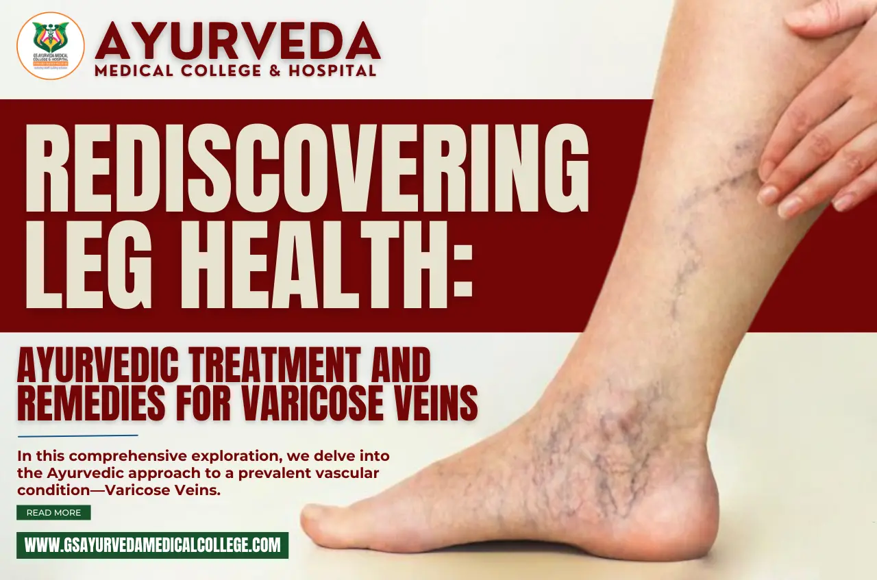 Rediscovering Leg Health: Ayurvedic Treatment and Remedies for Varicose Veins